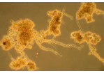 Klärwerk - Mikroorganismen