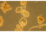 Klärwerk - Mikroorganismen